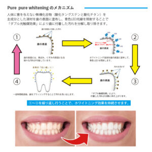 teethwhitening